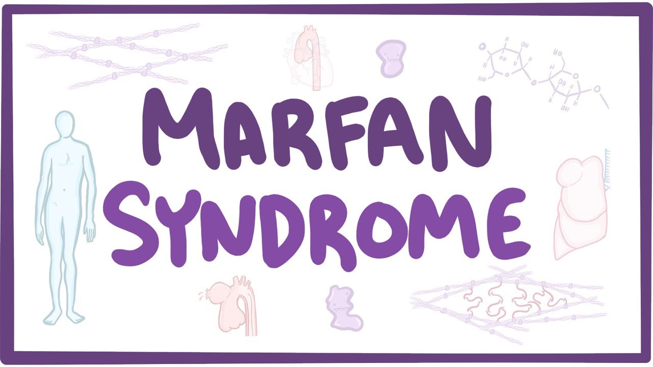 Marfan Syndrome - Causes, Symptoms, Diagnosis, Treatment, Pathology - 2024