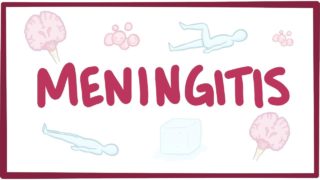 Meningitis – causes, symptoms, diagnosis, treatment, pathology
