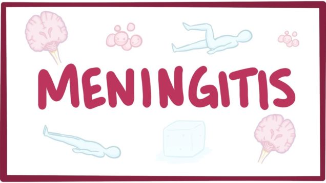 Meningitis – causes, symptoms, diagnosis, treatment, pathology