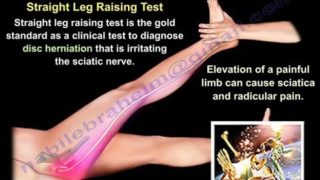 Piriformis Test – Everything You Need To Know – Dr. Nabil Ebraheim