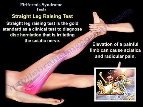Piriformis Test – Everything You Need To Know – Dr. Nabil Ebraheim