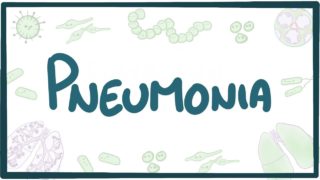 Pneumonia – causes, symptoms, diagnosis, treatment, pathology