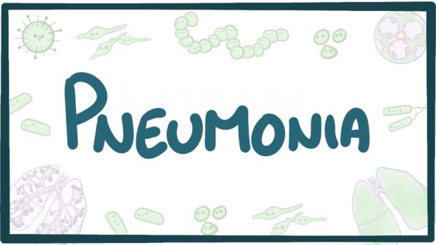 Pneumonia – causes, symptoms, diagnosis, treatment, pathology