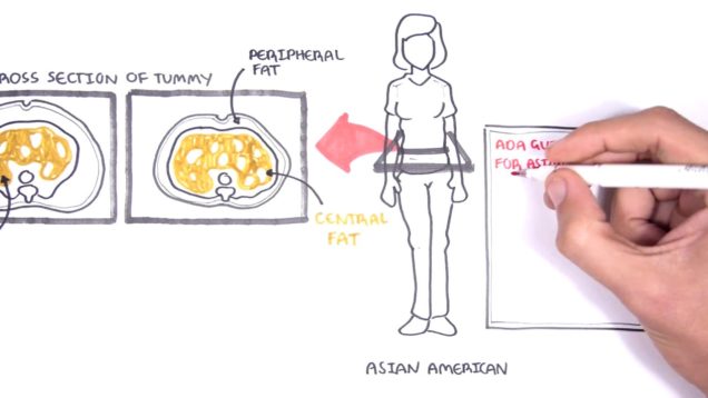 ADA New Diabetes Screening Guidelines