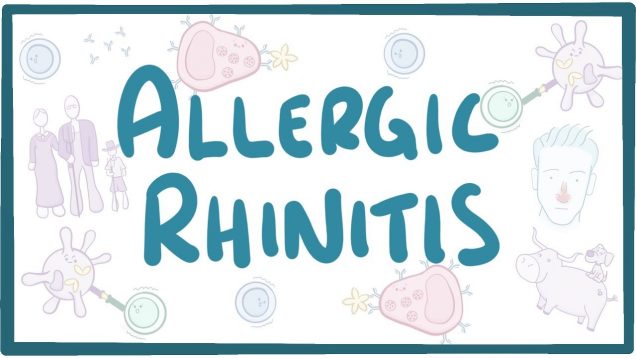 Allergic Rhinitis – causes, symptoms, diagnosis, treatment, pathology