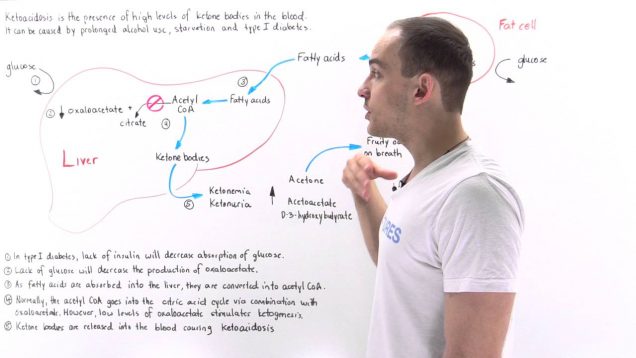 Diabetic Ketoacidosis