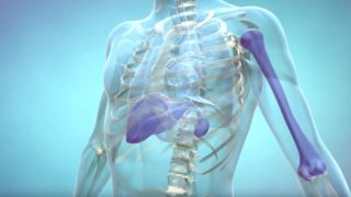 What is Gaucher Disease?