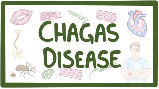 Chagas disease – causes, symptoms, diagnosis, treatment, pathology