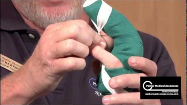 Finger Splint Technique
