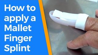 How to apply a Mallet Finger Splint