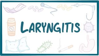 Laryngitis – causes, symptoms, diagnosis, treatment, pathology
