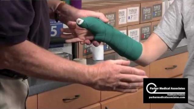 Thumb Spica Splint Technique