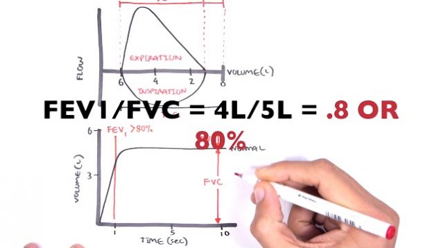 Understanding Spirometry – Normal, Obstructive vs Restrictive