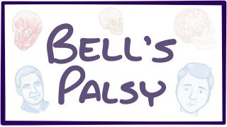 Bell’s Palsy – causes, symptoms, diagnosis, treatment, pathology