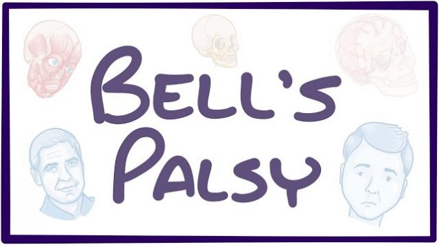 Bell’s Palsy – causes, symptoms, diagnosis, treatment, pathology