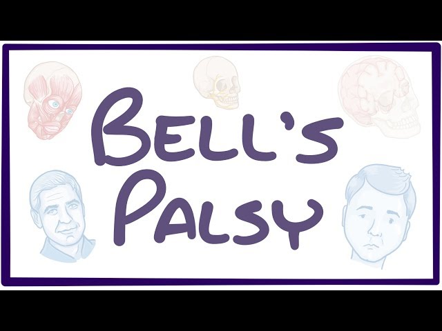 Bell's Palsy - causes, symptoms, diagnosis, treatment, pathology