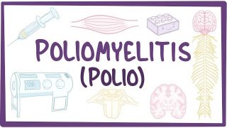 Poliomyelitis – causes, symptoms, diagnosis, treatment, pathology