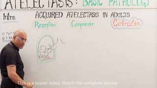 Atelectasis – Resorption, Compression & Contraction