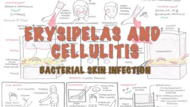 Bacterial Skin Infection – Cellulitis and Erysipelas (Clinical Presentation, Pathology, Treatment)