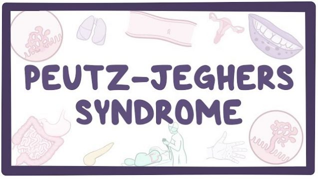 Peutz-Jeghers syndrome – causes, symptoms, diagnosis, treatment, pathology