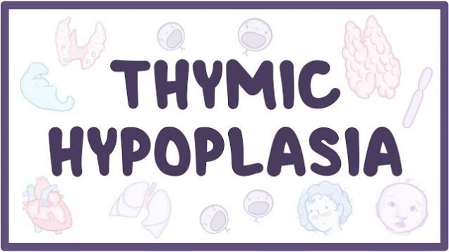 Thymic hypoplasia – causes, symptoms, diagnosis, treatment, pathology