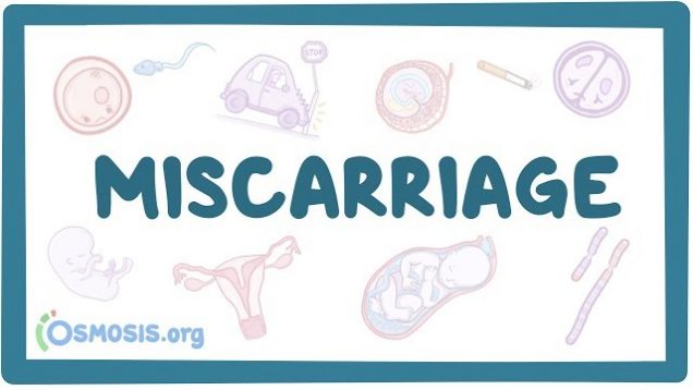 Miscarriage