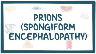 Prions (Spongiform encephalopathy)