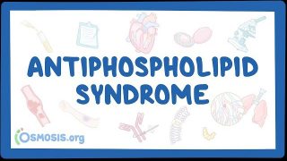 Antiphospholipid syndrome – causes, symptoms, diagnosis, treatment, pathology