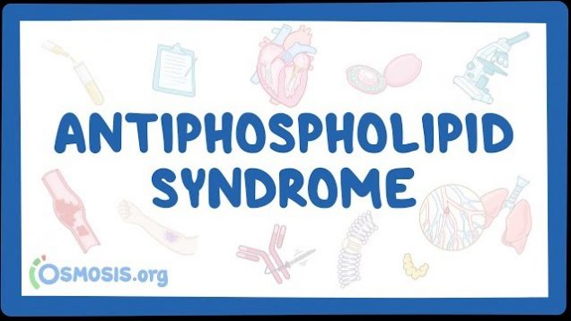 Antiphospholipid syndrome – causes, symptoms, diagnosis, treatment, pathology