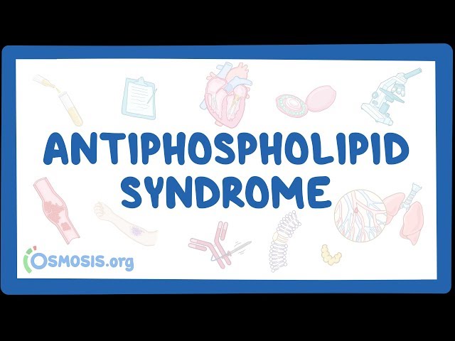 Antiphospholipid syndrome – causes, symptoms, diagnosis, treatment, pathology