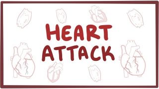 Heart attack (acute myocardial infarction) – causes, symptoms, diagnosis, treatment, pathology