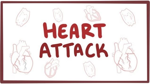 Heart attack (acute myocardial infarction) – causes, symptoms, diagnosis, treatment, pathology