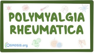 Polymyalgia rheumatica