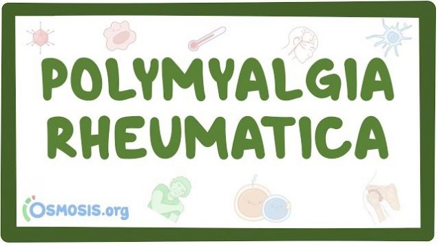 Polymyalgia rheumatica