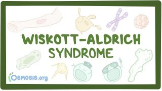 Wiskott-Aldrich syndrome