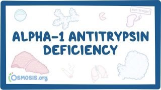 Alpha-1 Antitrypsin Deficiency – causes, symptoms, diagnosis, treatment, pathology