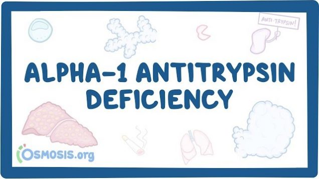 Alpha-1 Antitrypsin Deficiency – causes, symptoms, diagnosis, treatment, pathology