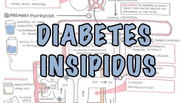 Diabetes Insipidus – Overview (causes, pathophysiology, investigations)