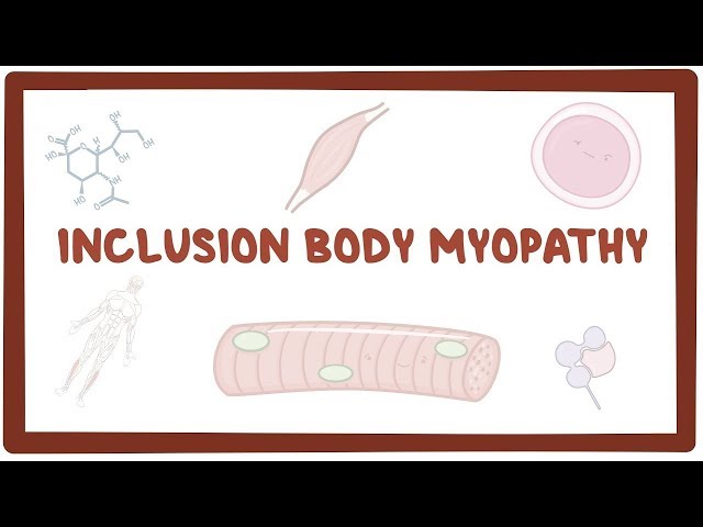 Inclusion Body Myopathy - Causes, Symptoms, Diagnosis, Treatment ...