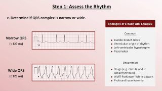 Intro to EKG Interpretation – A Systematic Approach