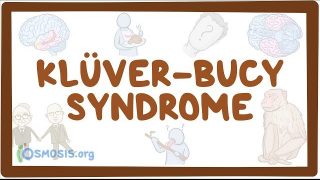 Klüver-Bucy syndrome – causes, symptoms, diagnosis, treatment, pathology