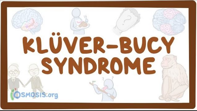 Klüver-Bucy syndrome – causes, symptoms, diagnosis, treatment, pathology
