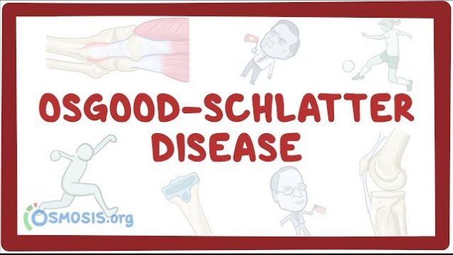 Osgood-Schlatter disease – causes, symptoms, diagnosis, treatment, pathology