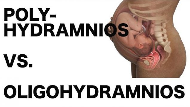 Polyhydramnios vs. Oligohydramnios