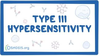 Type III hypersensitivity (immune complex mediated) – causes, symptoms & pathology