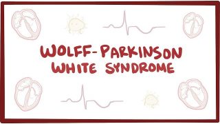 Wolff-Parkinson-White syndrome (WPW) – an Osmosis Preview