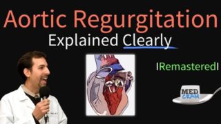 Aortic Regurgitation (Aortic Insufficiency) Explained Clearly – Remastered