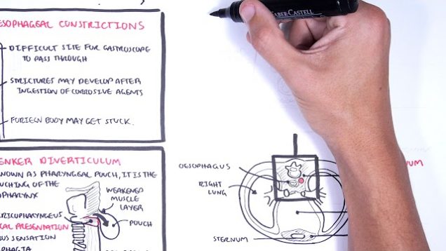 Clinical Anatomy – Oesophagus (esophagus)