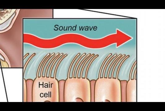 3 Different Types of Hearing Loss | Ear Problems