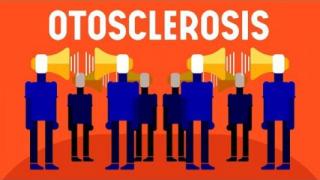 What is Otosclerosis?